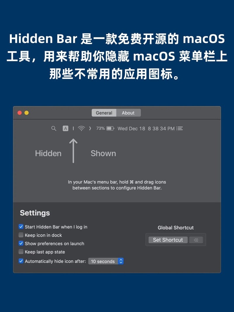 APP