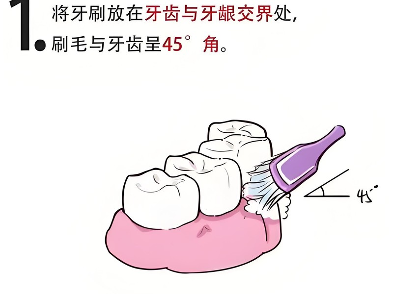���ɨ��綯��ˢ